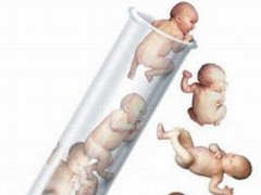 牡丹江市三代试管供卵婴儿周期费用介绍